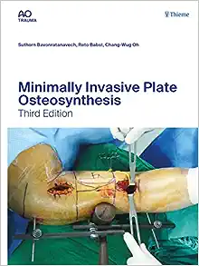 Minimally Invasive Plate Osteosynthesis (AO-Publishing), 3rd edition (ePub+Converted PDF)