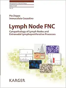 Lymph Node Fnc: Cytopathology of Lymph Nodes and Extranodal Lymphoproliferative Processes (Monographs in Clinical Cytology) (EPUB)