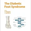 The Diabetic Foot Syndrome (Frontiers in Diabetes) (EPUB)