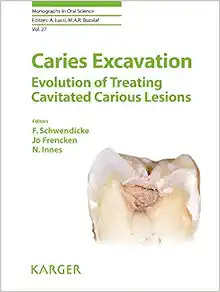 Caries Excavation: Evolution of Treating Cavitated Caries Lesions (Monographs In Oral Science) (EPUB)