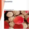 Fast Facts: Leucemia (Spanish Edition) (Original PDF from Publisher)