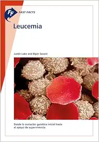 Fast Facts: Leucemia (Spanish Edition) (Original PDF from Publisher)