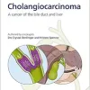 Fast Facts for Patients and Supporters: Cholangiocarcinoma (EPUB)