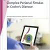Fast Facts: Complex Perianal Fistulas in Crohn’s Disease (Original PDF from Publisher)