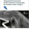 Integrated Intraoperative Ocular Coherence Tomography for Pediatric Ocular Surgery (EPUB)