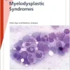 Fast Facts: Myelodysplastic Syndromes (Original PDF from Publisher)