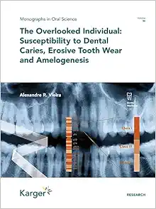 The Overlooked Individual: Susceptibility to Dental Caries, Erosive Tooth Wear and Amelogenesis (Monographs In Oral Science, 30) (Original PDF from Publisher)