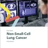 Fast Facts: Non-Small-Cell Lung Cancer, 2nd Edition (Original PDF from Publisher)