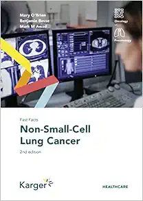 Fast Facts: Non-Small-Cell Lung Cancer, 2nd Edition (Original PDF from Publisher)