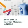 Fast Facts: EGFR Exon 20 Insertion Mutations in NSCLC (Original PDF from Publisher)