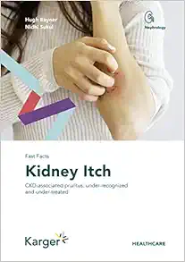 Fast Facts: Kidney Itch (Original PDF from Publisher)