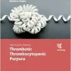 Fast Facts for Patients: Thrombotic Thrombocytopenic Purpura: Prompt action saves lives (Original PDF from Publisher)