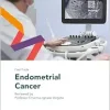 Fast Facts: Endometrial Cancer (EPUB)