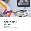 Fast Facts: Endometrial Cancer (Original PDF from Publisher)