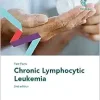 Fast Facts: Chronic Lymphocytic Leukemia, 2nd Edition (Original PDF from Publisher)