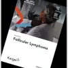 Fast Facts: Follicular Lymphoma (Original PDF from Publisher)