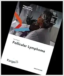 Fast Facts: Follicular Lymphoma (Original PDF from Publisher)