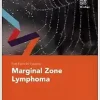 Fast Facts for Patients: Marginal Zone Lymphoma (Original PDF from Publisher)