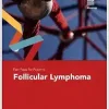 Fast Facts for Patients: Follicular Lymphoma (Original PDF from Publisher)