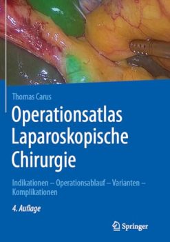 Operationsatlas Laparoskopische Chirurgie: Indikationen – Operationsablauf – Varianten – Komplikationen (German Edition) (Original PDF from Publisher)