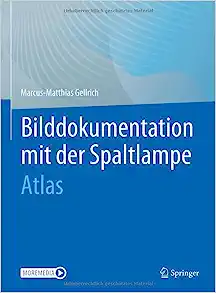 Bilddokumentation mit der Spaltlampe: Atlas (German Edition) (Original PDF from Publisher)