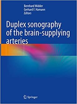 Duplex sonography of the brain-supplying arteries (EPUB)
