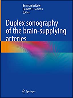 Duplex sonography of the brain-supplying arteries (EPUB)