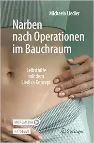 Narben nach Operationen im Bauchraum: Selbsthilfe mit dem Liedler-Konzept (German Edition) (EPUB)