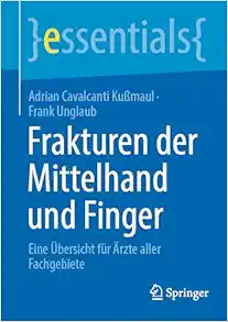Frakturen der Mittelhand und Finger: Eine Übersicht für Ärzte aller Fachgebiete (essentials) (German Edition) (Original PDF from Publisher)