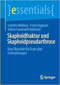 Skaphoidfraktur und Skaphoidpseudarthrose: Eine Übersicht für Ärzte aller Fachrichtungen (essentials) (German Edition) (EPUB)