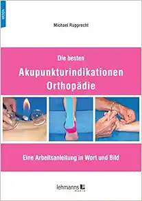 Die besten Akupunkturindikationen Orthopädie (Original PDF from Publisher)