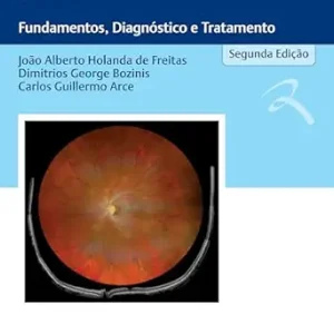 Laser: Fundamentos, Diagnóstico e Tratamento (Portuguese Edition) (EPUB)