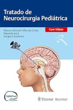 Tratado de Neurocirurgia Pediátrica (Portuguese Edition) (EPUB)