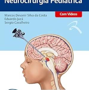 Tratado de Neurocirurgia Pediátrica (Portuguese Edition) (EPUB)