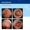 Histeroscopia: Manual Ilustrado (Portuguese Edition) (EPUB)