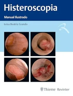 Histeroscopia: Manual Ilustrado (Portuguese Edition) (EPUB)