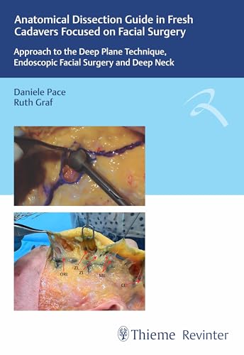 Anatomical Dissection Guide in Fresh Cadavers Focused on Facial Surgery: Approach to the Deep Plane Technique, Endoscopic Facial Surgery and Deep Neck (EPUB)