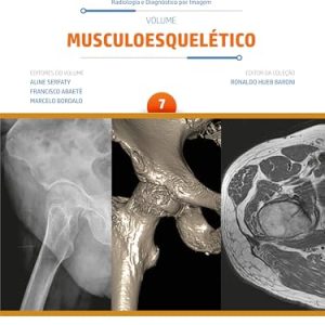 Coleção CBR Volume 7 – Musculoesquelético (Portuguese Edition) (EPUB)