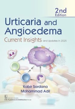 Urticaria and Angioedema Current Insights and Updates in 2025, 2nd edition (Original PDF from Publisher)