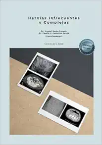 Hernias Infrecuentes y Complejas (Original PDF from Publisher)