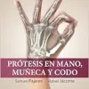 Prótesis en mano, muñeca y codo (True PDF from Publisher)