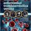 Compendio de enfermedad tromboembólica venosa, 2.ª edición (Original PDF from Publisher)