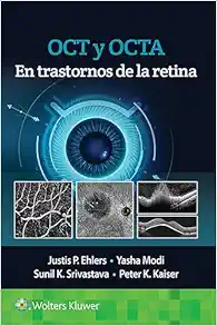 OCT y OCTA en trastornos de la retina (Spanish Edition) (Original PDF from Publisher)