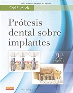 Prótesis dental sobre implantes (Spanish Edition), 2e  (PDF)