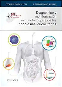 Diagnóstico y monitorización inmunofenotípica de las neoplasias leucocitarias: Sociedad Española de Inmunología (Original PDF from Publisher)
