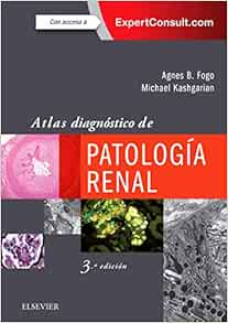 Atlas diagnóstico de patología renal, 3rd Edition (Original PDF from Publisher)