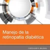 Manejo de la retinopatía diabética (Spanish Edition) (Original PDF from Publisher)