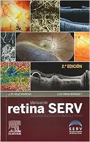 Manual de retina SERV, 2nd Edition (Original PDF from Publisher)