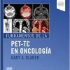 Fundamentos de la PET-TC en oncología (Original PDF from Publisher)