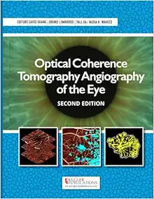 Optical Coherence Tomography Angiography of the Eye, 2nd edition (ePub)
